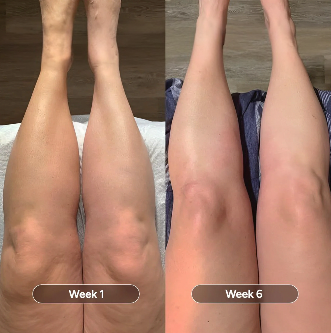 NoOil™ Anti-Cellulite Oil